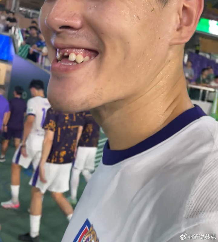 ewc数据-津门虎0-2负浙江遭遇失利，中卫王献钧拼抢中门牙遭撞击脱落